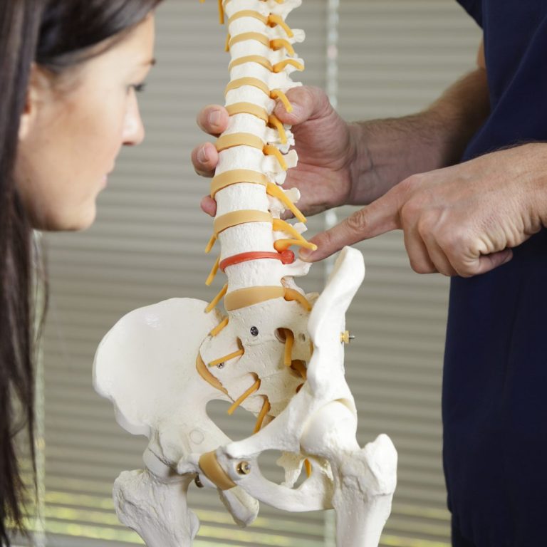 Während der Therapie erklärt der Therapeut einer Dame anhand eines Skeletts die Auswirkungen eines Bandsceibenvorfalls